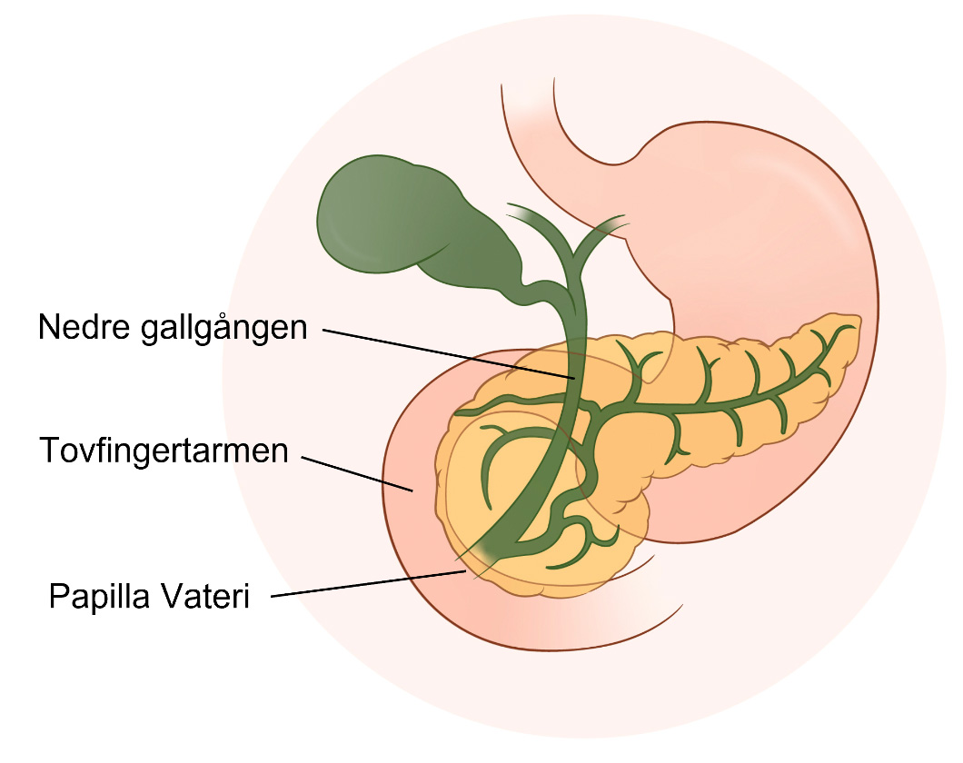Illustration med buskpottk&ouml;rtelns delar.