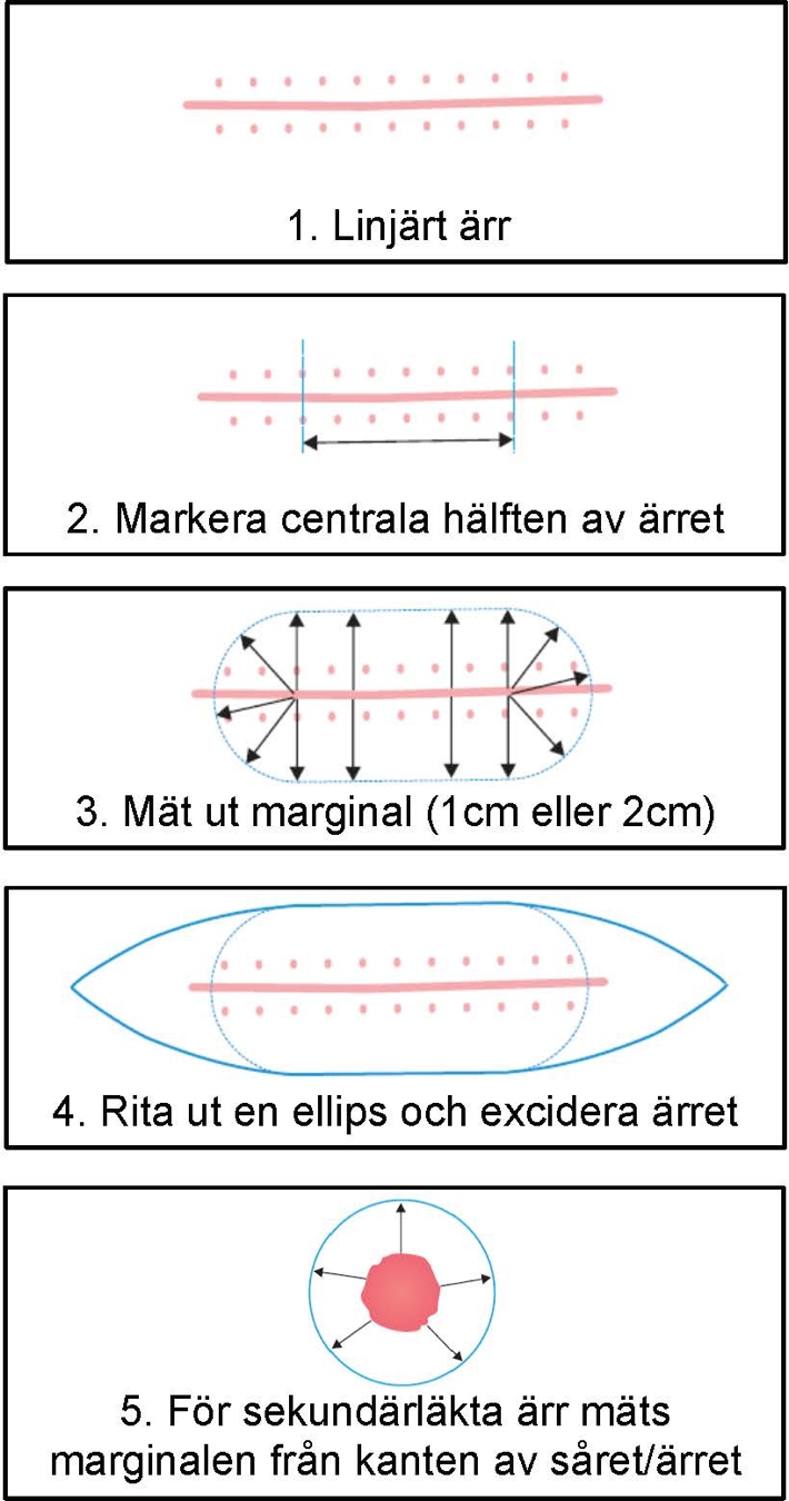 Fem tecknade bilder med instruktion till hur marginalen ska mätas ut.