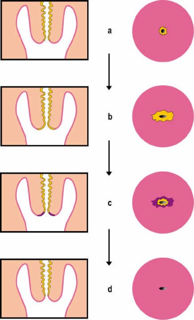 Kap 11.3 Fig 2 Fig 3.jpg