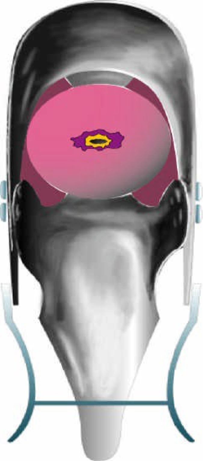 Kap 11.3 Fig 5.jpg