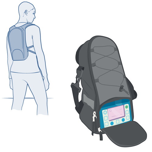 Illustration med ryggsäck för pump till sondnäring.