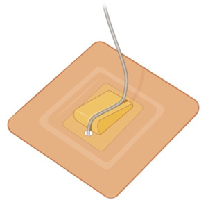 Illustration av förband till dränage.