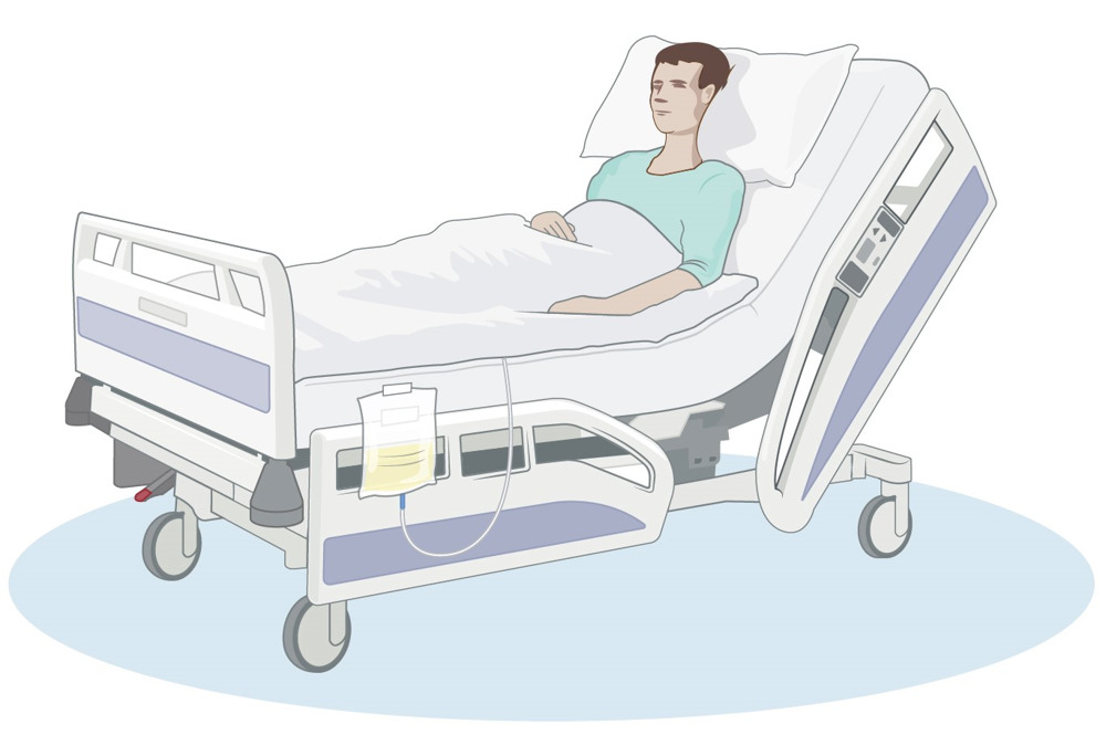 Patient liggande i sjukhussäng. En slang leder till en urinpåse som hänger på sidan av sängen.