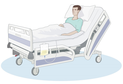 En patient ligger i en sjukhussäng. En tunn slang kopplad till en urinpåse leder in under täcket.
