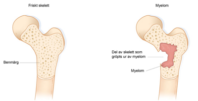 En bild som visar ett normalt ben i genomskärning.