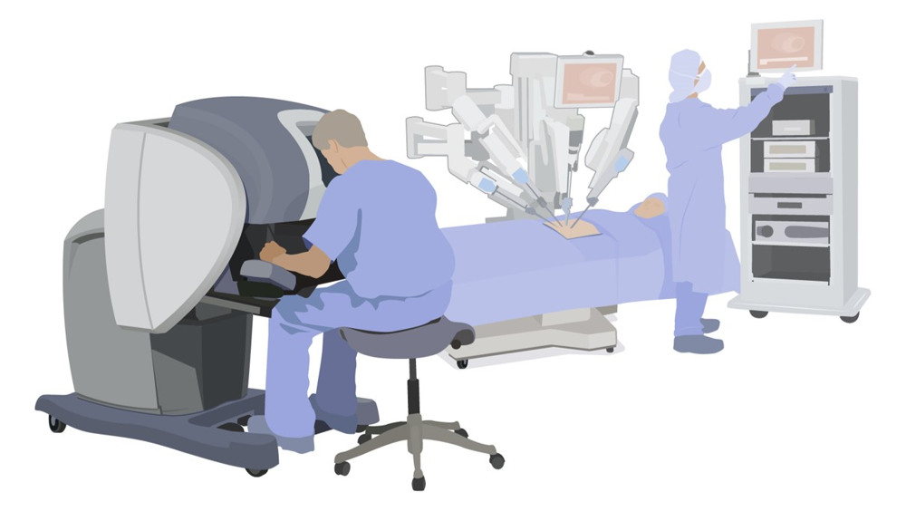 Robotassisterad titthålsoperation i buken. Patienten ligger på ett operationsbord under robotens armar. En kirurg sitter vid en konsol och styr instrumenten med hjälp av en tredimensionell kamera. Intill patienten står en vårdpersonal och övervakar teknisk utrustning.