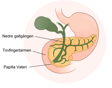 Anatomisk illustration av nedre gallgången, tolvfingertarmen och bukspottkörteln.