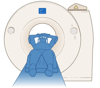 Illustration av en person som ligger på en brits på väg in i en rund PET-kamera. Bilden visar tydligt utrustningens cirkulära öppning och patientens position. 